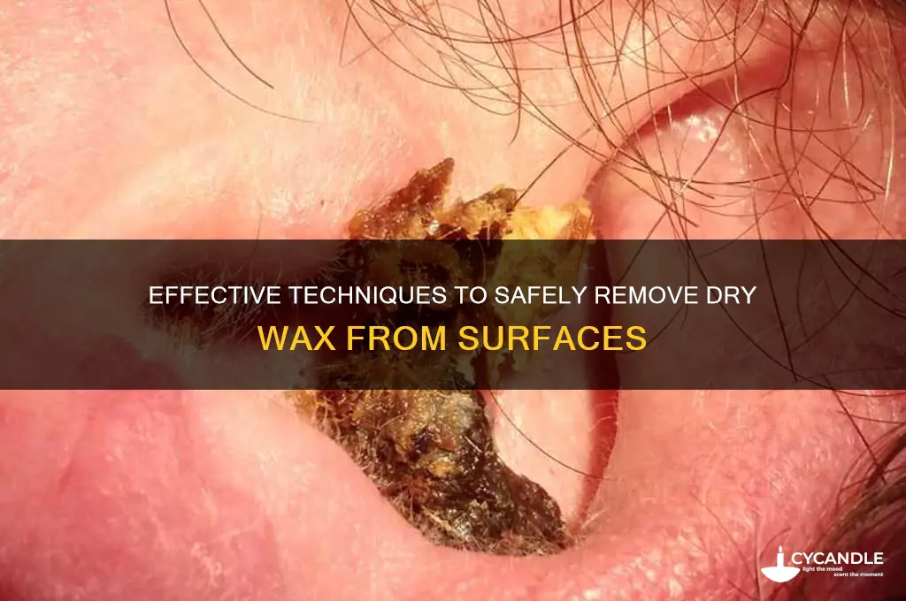 how to remove dry wax