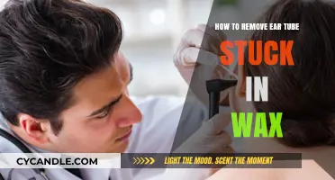 Effective Tips to Safely Remove Ear Tubes Stuck in Earwax