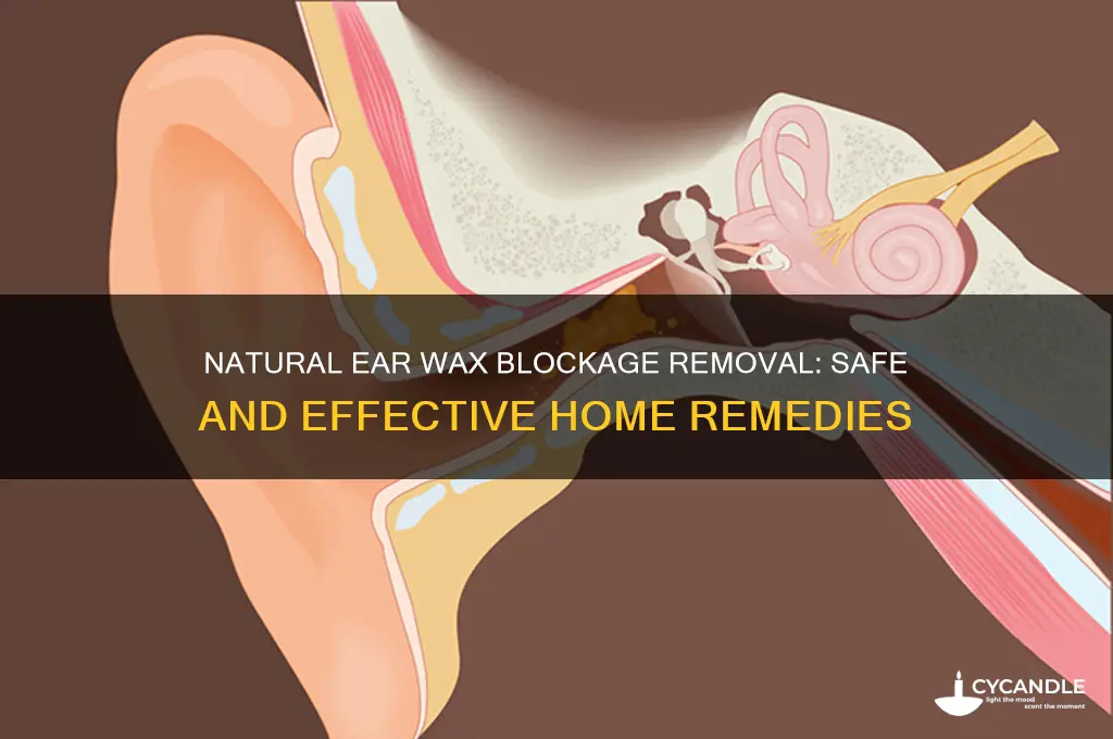 how to remove ear wax blockage naturally