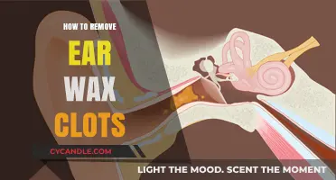 Effective Ear Wax Clot Removal: Safe and Simple Home Remedies