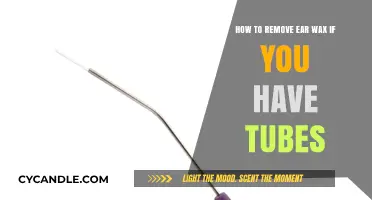 Safe Ear Wax Removal Tips for Those with Ear Tubes