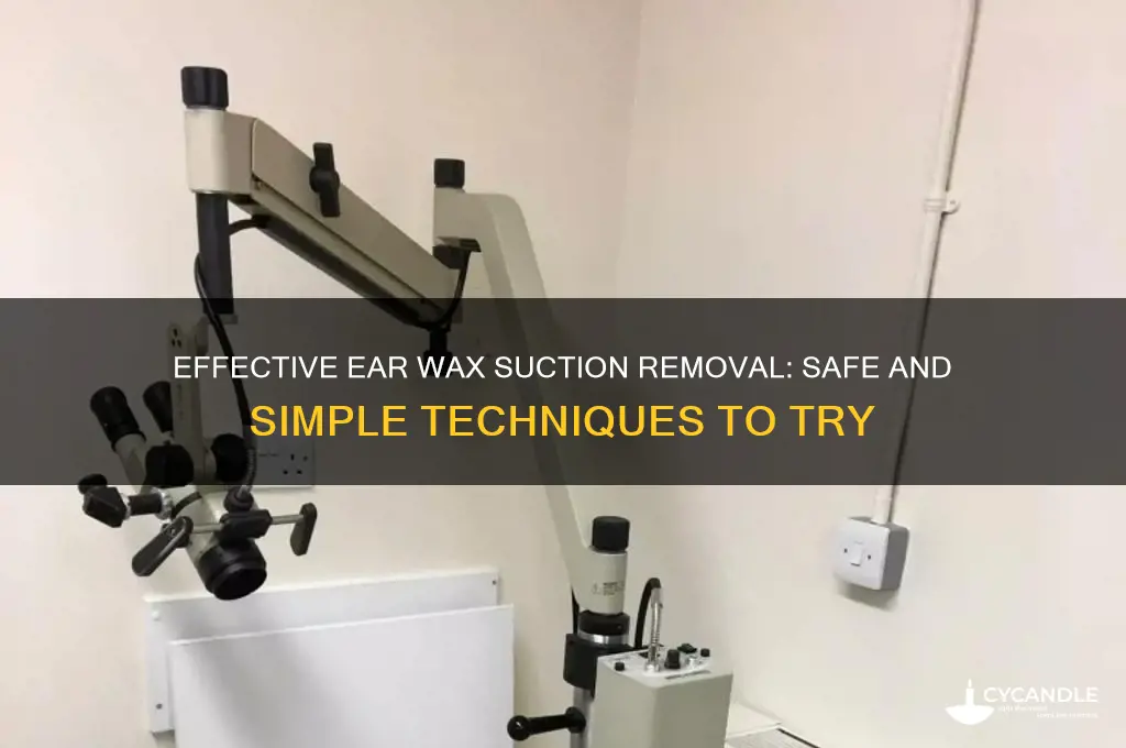 how to remove ear wax suction