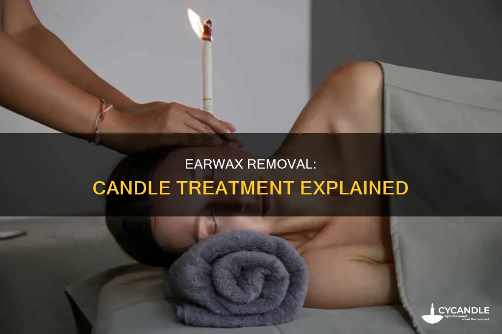 how to remove earwax with candle