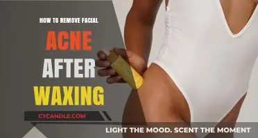 Post-Wax Acne Relief: Effective Tips to Clear Facial Breakouts Fast