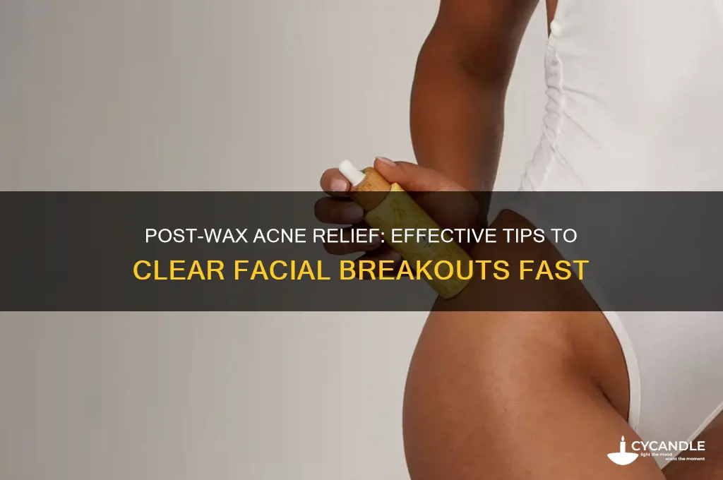 how to remove facial acne after waxing