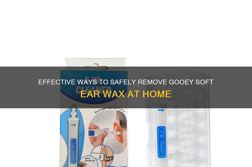 how to remove gooey soft ear wax