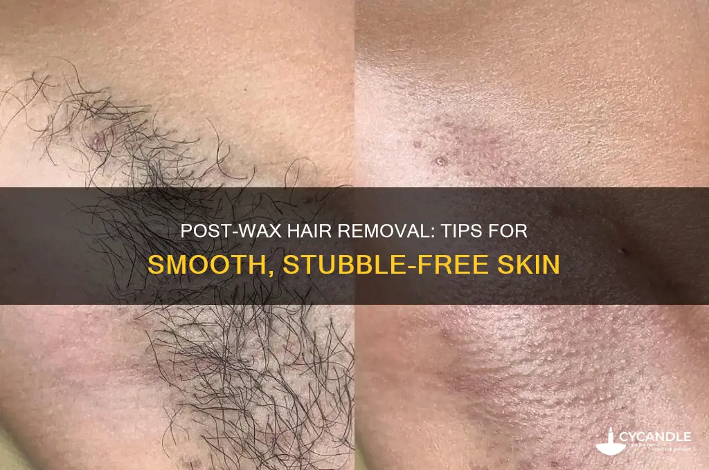 how to remove hair after a wax