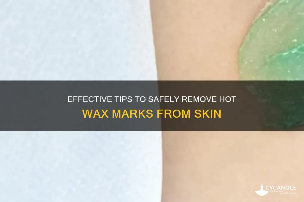 how to remove hot wax marks from skin