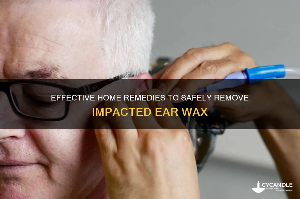 how to remove impacted ear wax at home