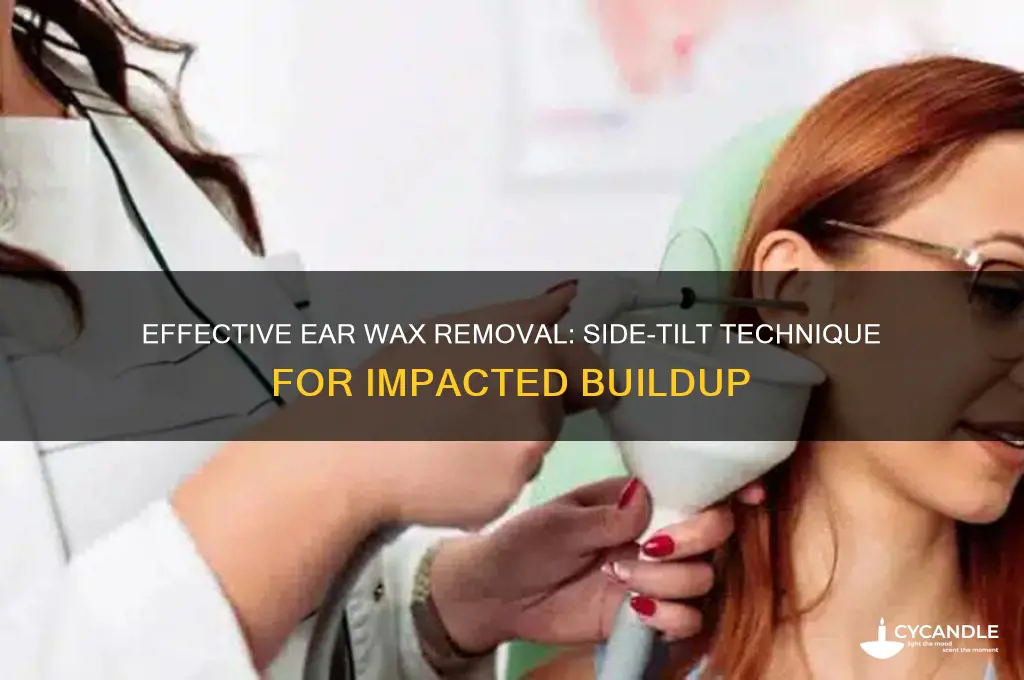 how to remove impacted ear wax head to the side