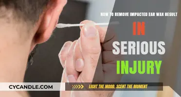 Safely Removing Impacted Ear Wax: Preventing Serious Injury and Complications