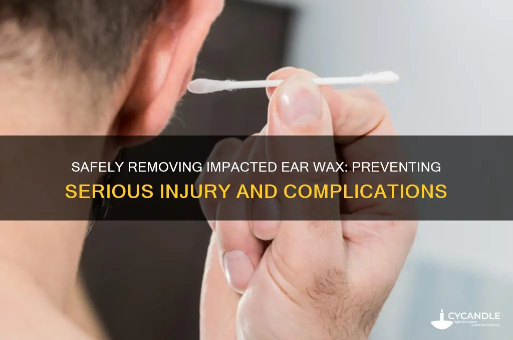 how to remove impacted ear wax result in serious injury