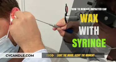 Safe Syringe Technique for Removing Impacted Ear Wax at Home