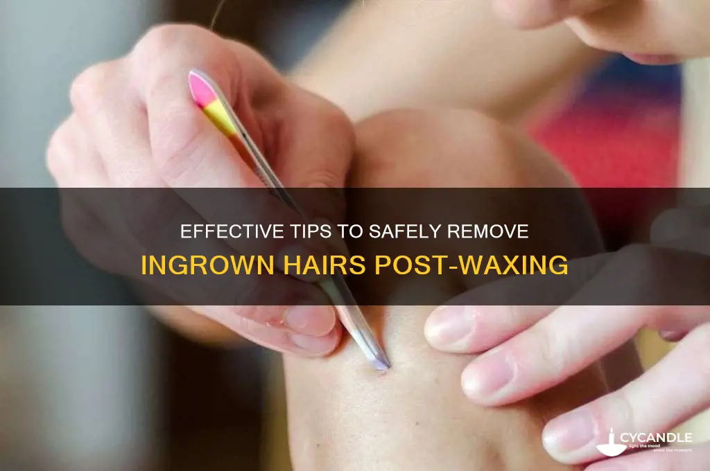 how to remove ingrown hair after waxing