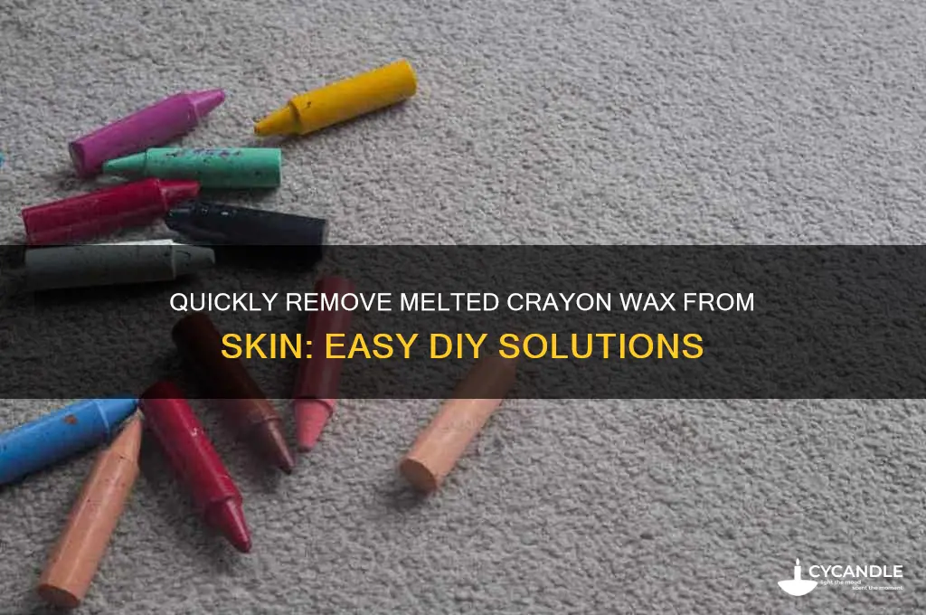 how to remove melted crayon wax from skin