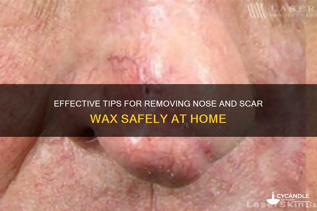 how to remove nose and scar wax