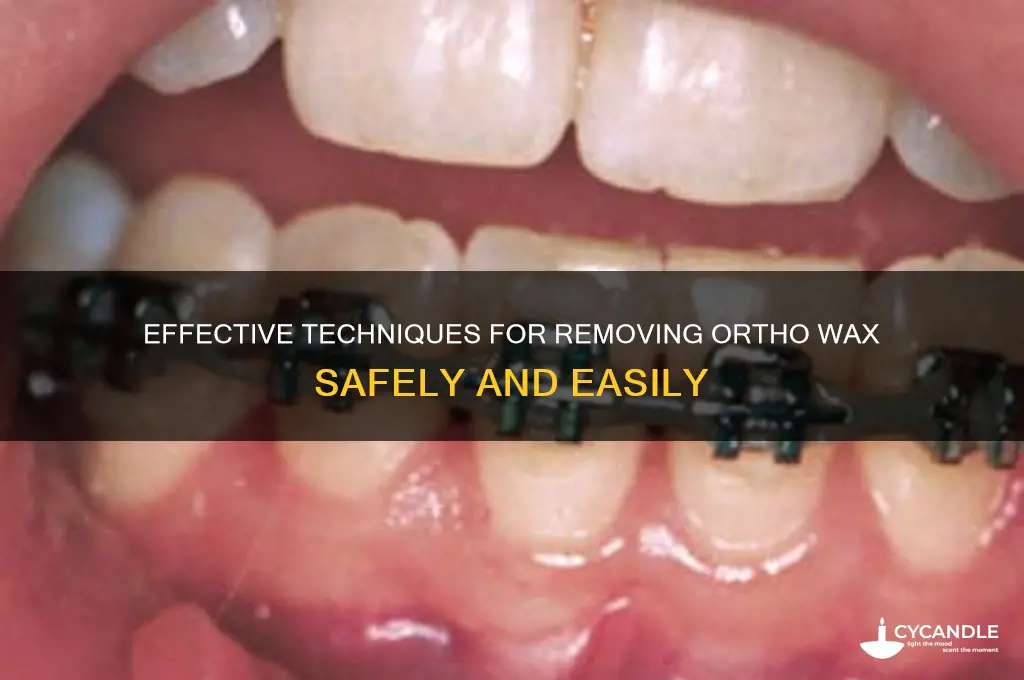 how to remove ortho wax
