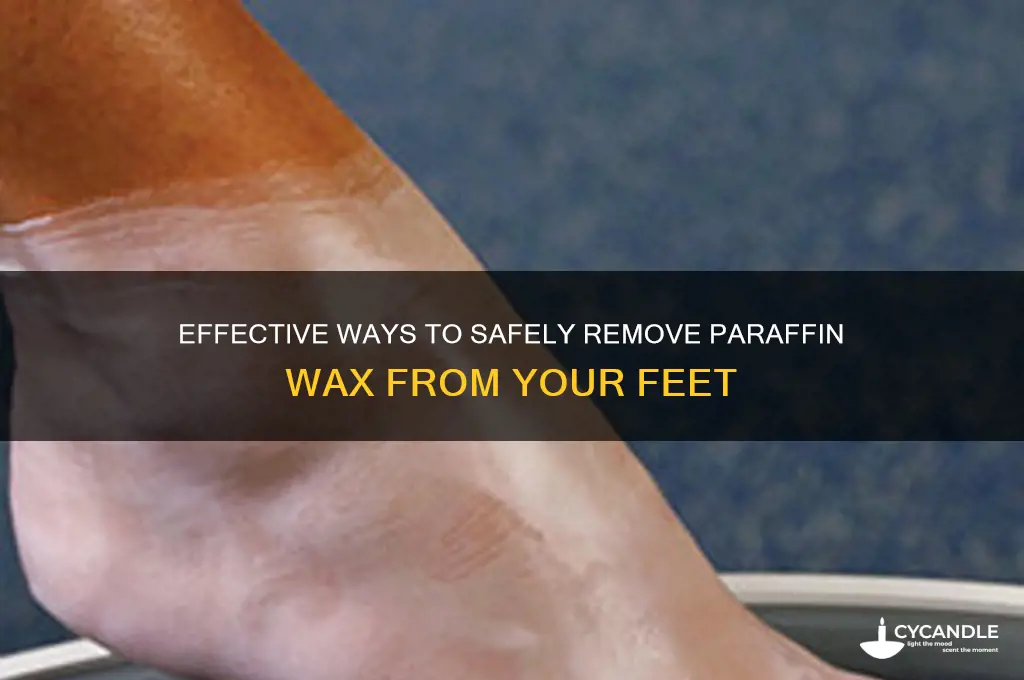 how to remove paraffin wax from feet