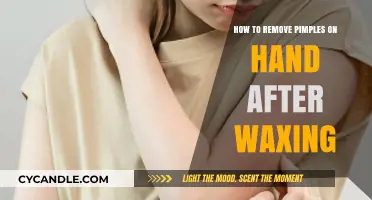 Effective Tips to Remove Hand Pimples Post-Waxing Fast and Safely