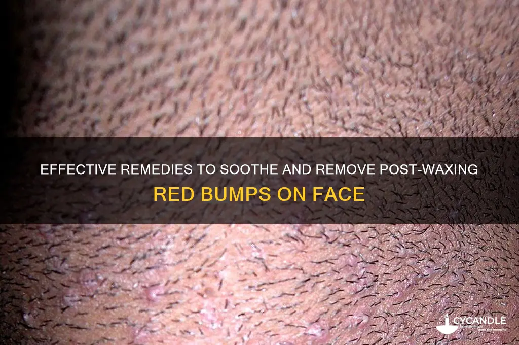 how to remove red bumps on face after waxing