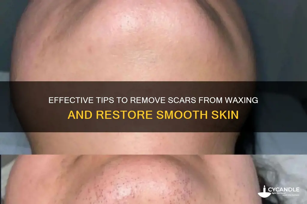 how to remove scars from waxing