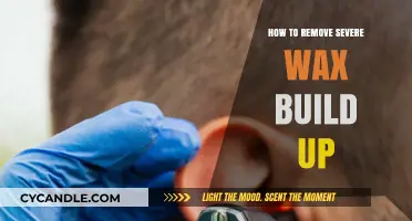 Effective Techniques to Safely Remove Severe Ear Wax Build Up