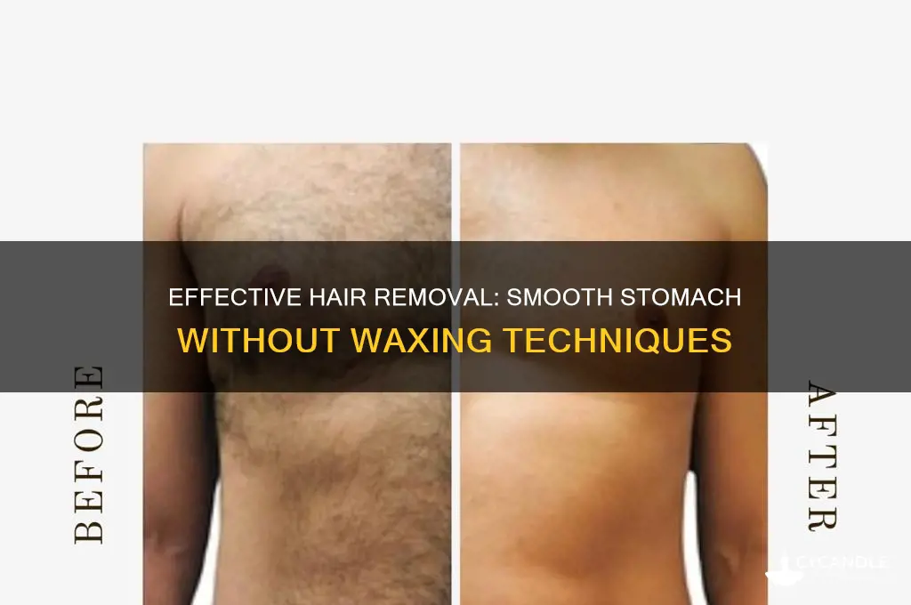 how to remove stomach hair without waxing