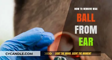 Effective and Safe Methods to Remove Wax Balls from Your Ears