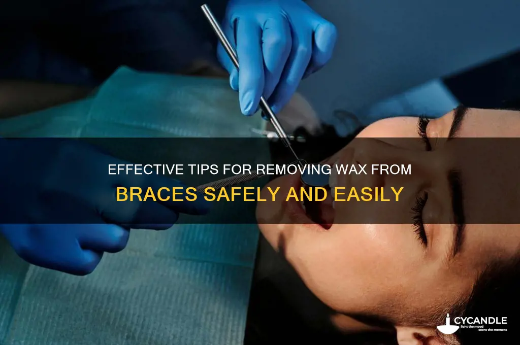 how to remove wax braces