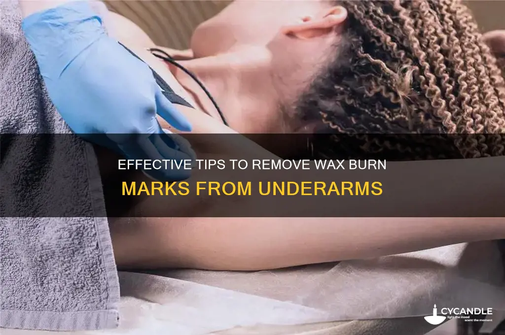 how to remove wax burn from underarms