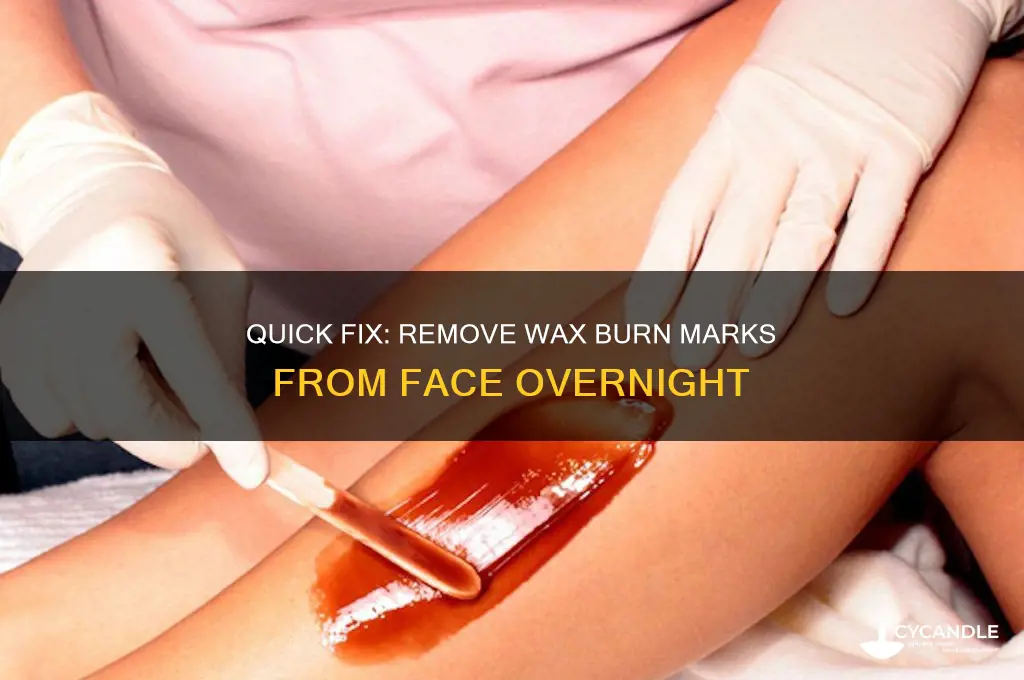 how to remove wax burn marks from face overnight