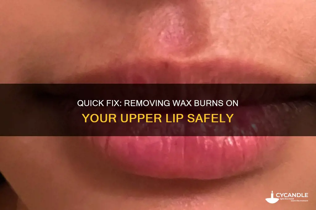 how to remove wax burn on upper lip