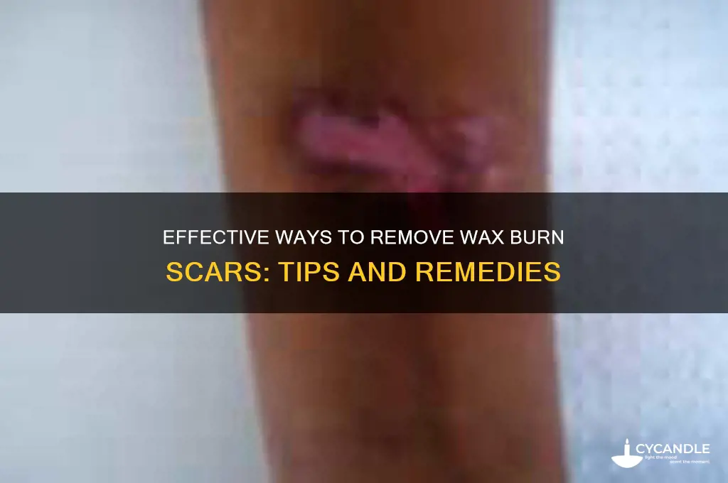 how to remove wax burn scar