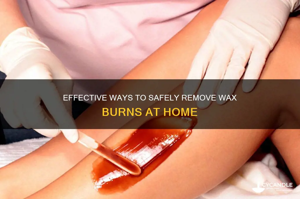 how to remove wax burn