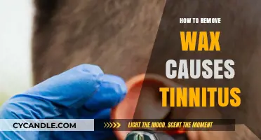 Effective Ways to Remove Ear Wax Causing Tinnitus Safely