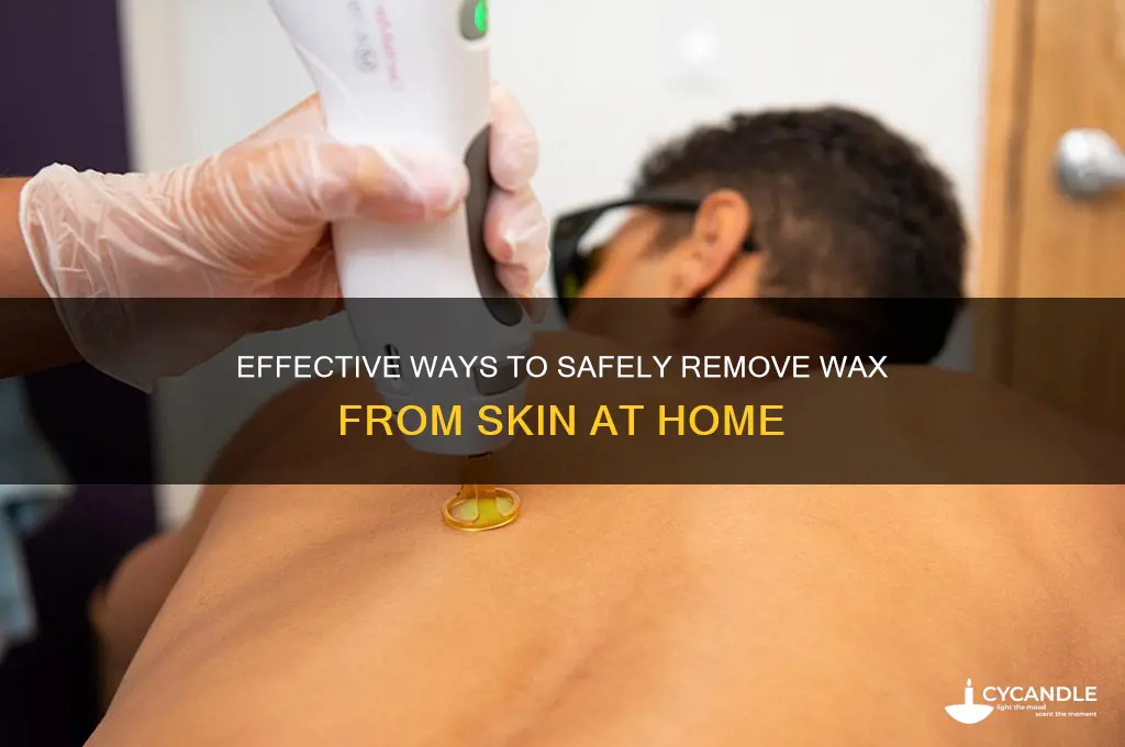 how to remove wax frmo skin