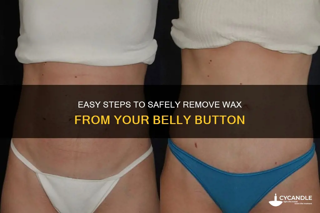 how to remove wax from belly button