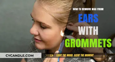 Safe Ear Wax Removal Tips for Grommet Users: A Step-by-Step Guide