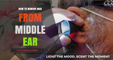 Effective Methods to Safely Remove Wax from the Middle Ear