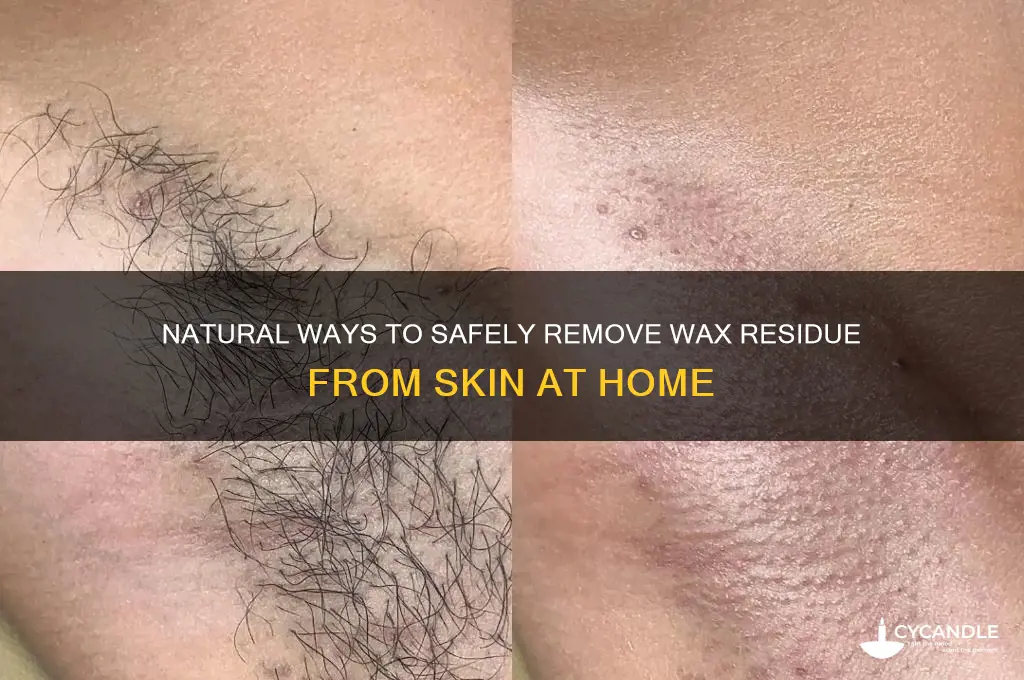 how to remove wax from skin naturally
