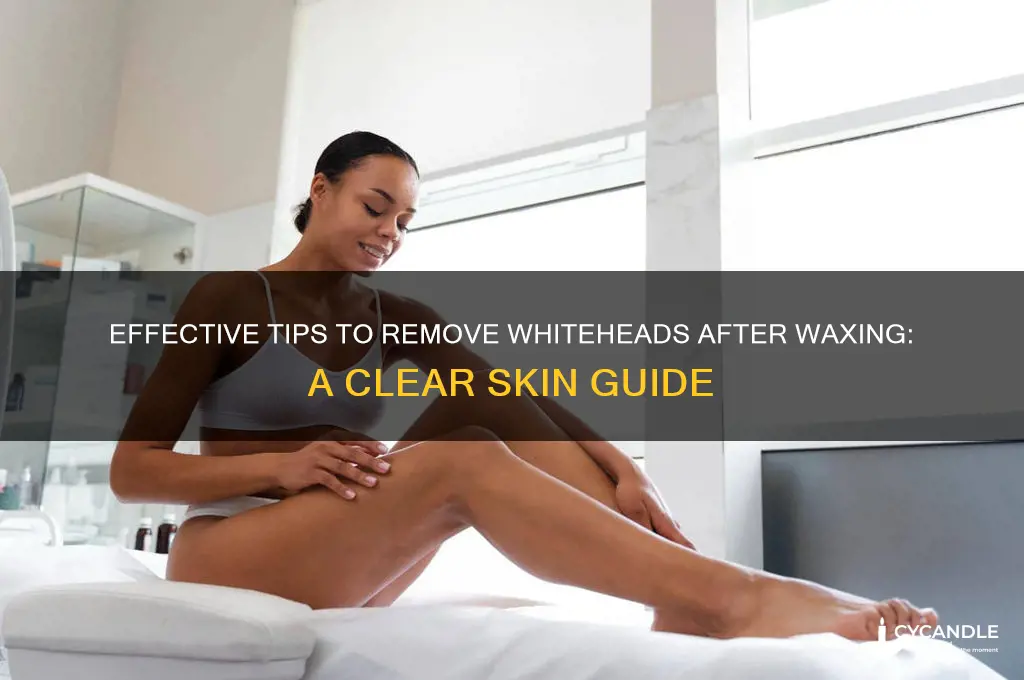 how to remove whiteheads after waxing
