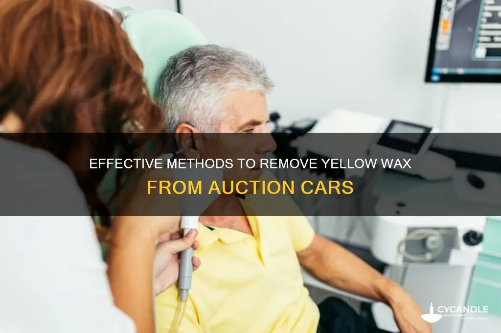 how to remove yellow wax auction cars