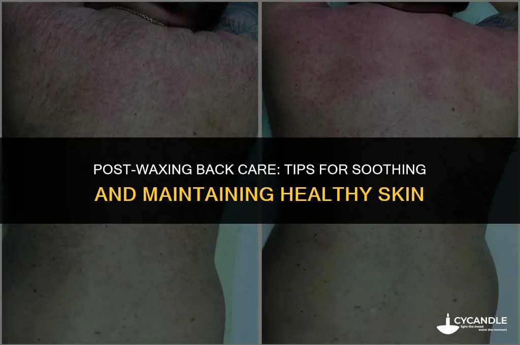 how to take care of your back after waxing