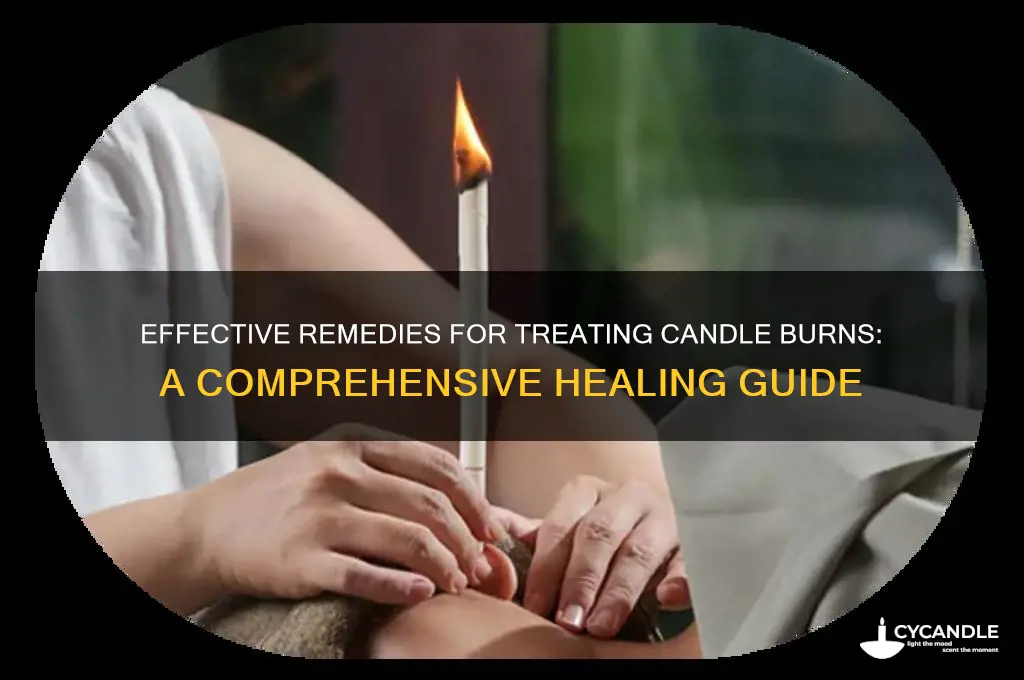 how to treat a candle burn