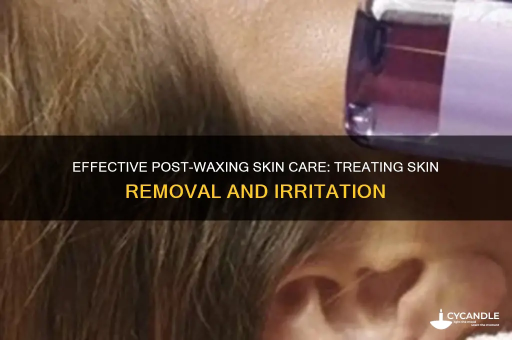 how to treat skin removal after waxing
