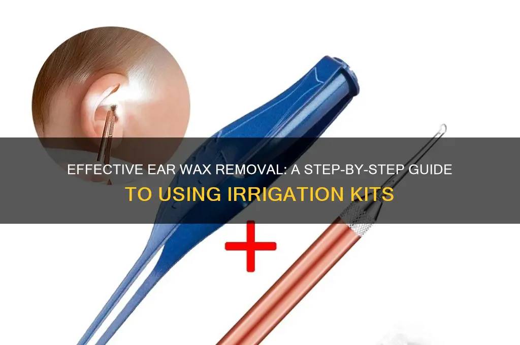 how to use ear wax removal irrigation kit
