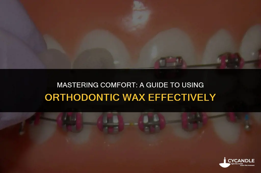 how to use orthodontic wax