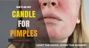 Soft Candle Pimple Remedy: A Gentle, Natural Acne Treatment Guide