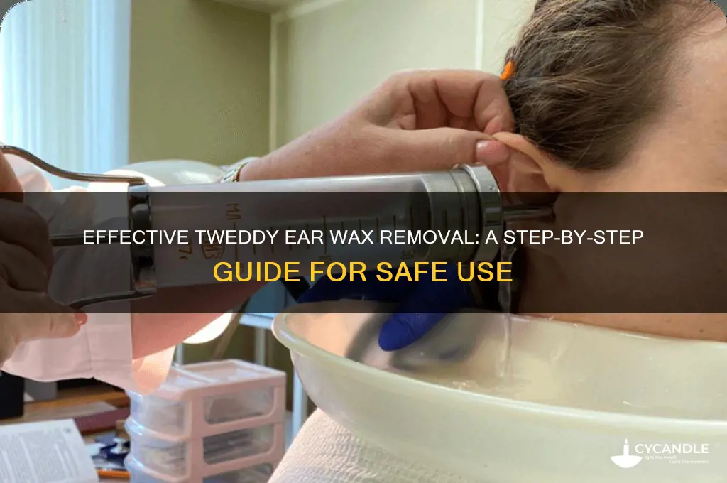 how to use tweddy ear wax removal