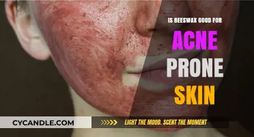 Beeswax Benefits: A Natural Remedy for Acne-Prone Skin?